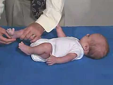 Neurology Exam, 3 Month: Reflexes - Plantar Reflex