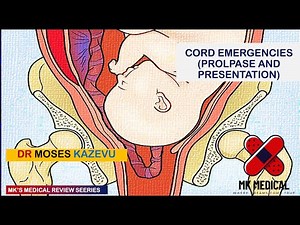 Cord Prolapse