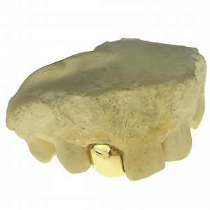 10K 14K 18K Gold Single Tooth Cap Grillz - Custom Fit, Handmade USA - Etsy