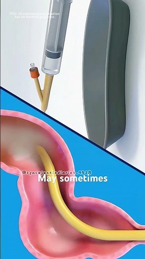 How enema therapy cleans your colon instantly (3D animation) #motivation #healthyroutine #feelbetter