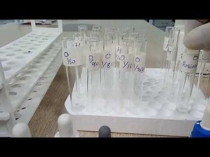 Widal Tube Method part 01