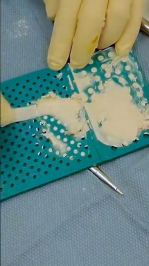 How to treat an infection! 🤯