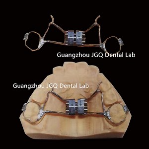 [Hot Item] Dental Orthodontic Expansion 3D Printing Screw Palatal Expander Rapid Maxillary Expansion