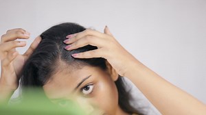 Androgenic alopecia, balding scalp, hairloss, a young woman examining her balding area in white background. | Premium Stock Video Footage