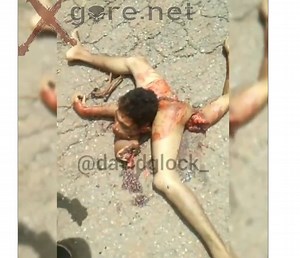 Gore video - They dismembered him then they arranged the body parts into a weird shape - XGore - Extreme Gore Videos