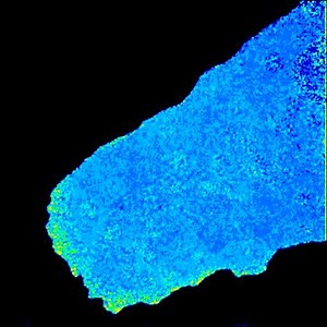 File:Abl-Kinases-Regulate-HGFMet-Signaling-Required-for-Epithelial-Cell-Scattering-Tubulogenesis-and-pone.0124960.s008.ogv - Wikimedia Commons