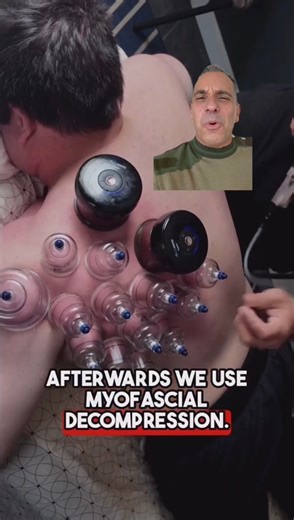 Is it WORTH it?! | Sebastian Maniscalco