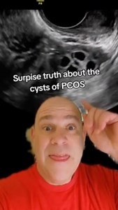 17K views · 44 reactions | the pcos cysts are actually eggs #pcos #cysts #infertility #IVF #ttc #infertilitywarrior #ivfwarrior #infertilityjourney #Reels #reelsvideo #reelsviral #reelinstagram | Steven Palter | Facebook