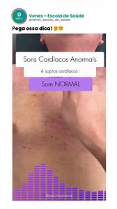 Você consegue diferenciar os sons cardíacos normais dos anormais? Vem revisar isso com a gente! 🩺 Sons cardíacos normais (S1 e S2): ➡️ S1 ("tump"): fechamento das válvulas AV (mitral e tricúspide). ➡️ S2 ("tá"): fechamento das válvulas semilunares (aórtica e pulmonar). ✨ São os sons que ouvimos ao auscultar um coração saudável! ⚠️ Sons cardíacos anormais: 🔹 S3: pode indicar falência cardíaca (som de “galope”). 🔹 S4: associado à rigidez do ventrículo (hipertrofia). 🔹 Sopros: fluxo turbulento,