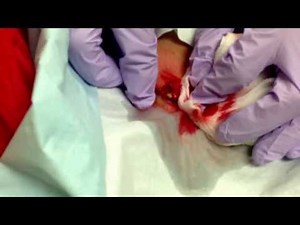 Brown recluse bite/Draining a brown recluse bite