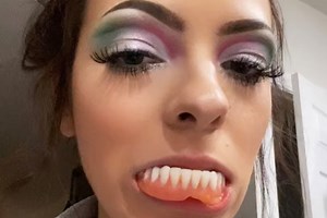 I lost my teeth & got dentures at 22- I love people's faces when I pop them out