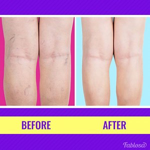 52K views · 504 reactions | Best exercises for 40+ women to have healthy and beautiful legs. | Tips & Tricks | Facebook