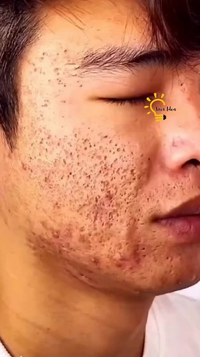 Green Tea Purifying Clay Stick Mask Link order here: https://cretaidea.com/products/green-tea-cleansing-bar-mask | Idea Flares