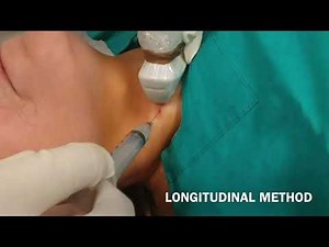 TMT: USG guided FNAC: Tips n Tricks by Dr Vishal Kumat