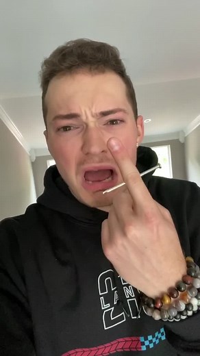 Nail in Finger Prank 🤣