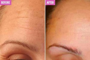 Wake Skincare’s £20 Anti-Wrinkle Cream is back on Amazon – after selling out when mum, 31, said she got ID’d