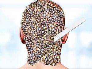 asmr# clean the scalp remove parasites maggots # asmr#