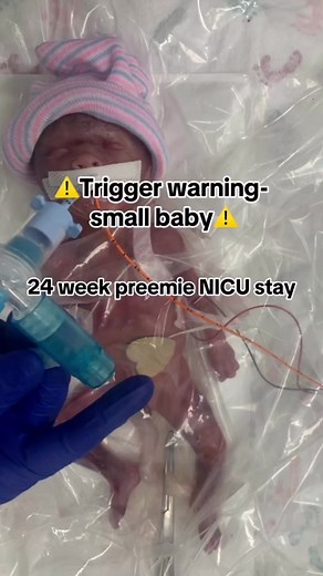 Micro preemie nicu stay 🫶🏼 #nicu #niculife #icu #iculife #micropreemie #preemie #prematurebaby #premature #prematurebabies #prematurebirth #micropreemiemom #micropreemiestrong #nicubaby #nicumom #nicustrong | Nicu baby