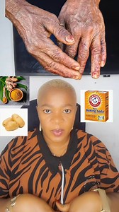 4.8K views · 68 reactions | How to remove old hands, remove wrinkles hands and fingers. Get younger Hands really f@st #naturalremedies #NaturalBeauty #NaturalSkincare #natural | Editorial Beauty556 | Facebook
