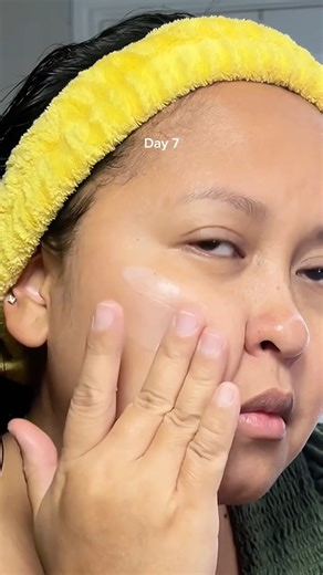 💎 Even tone, natural glow 🌿 @celyrecs makes clear skin look effortless with Skin Fade Cream. #SkinFadeCream #DermisaSkincare | Dermisa Skin Care