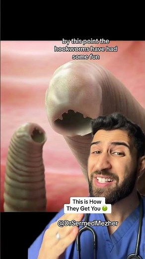 “It Was Just a Walk in the Park” #hookworm