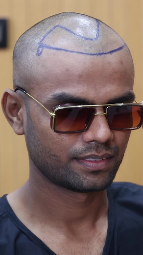 8.8K views · 72 reactions | Take Your Free Hair Analysis Test  Link...