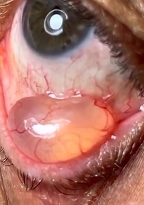 41K views · 142 reactions | Diagnostic ?? | Dr Brahim Réa | Facebook