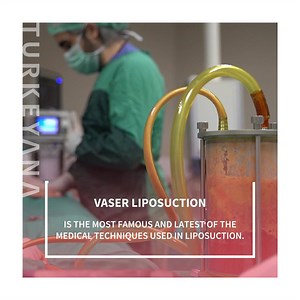 Vaser is a famous and new medical technique used in liposuction. It is based on sound waves that break down fat accumulated in different areas of the body, where the fat is removed by a Cannula connected to the tube, which in turn sucks the fat. The Cannula is inserted into the patient’s body by small incisions that the doctor slits before he sucks the fat. #istanbul #turkeyana #turkeyanaclinic #changeyourlife #trusttheexperts #liposuction #weightloss | Turkeyana Clinic | Facebook