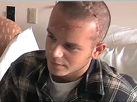 Adam's Story: Walking & Talking After a Traumatic Brain Injury