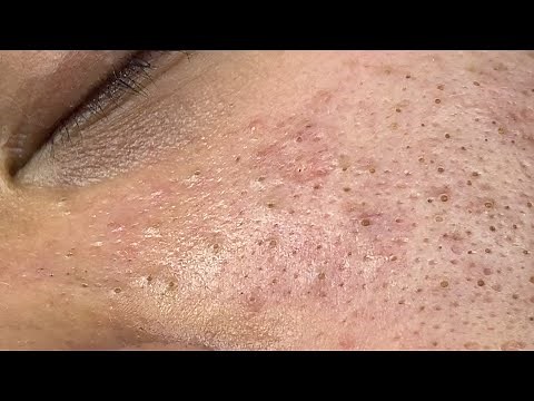 Satisfying and Relaxation with SURI NGUYEN Beauty Spa Video #308