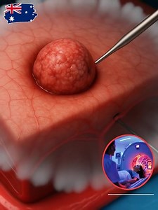 200K views · 52 reactions |  Australia has taken a significant step...