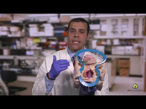 Artificial Urinary Sphincter/ Urethroplasty Model | SLICE
