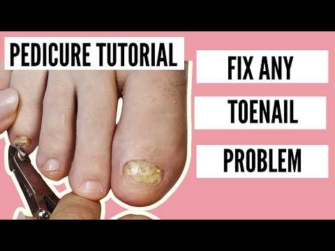Learn How to Fix Your Toenails at Home