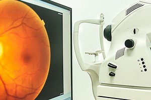 What is retinal fluorangiography and what are the risks?