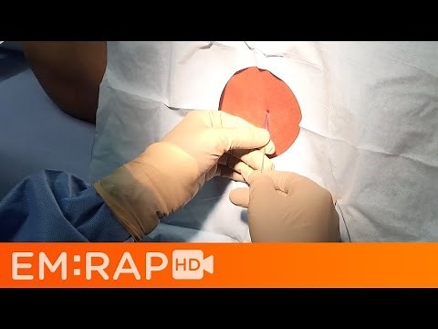 Lumbar Puncture Tutorial