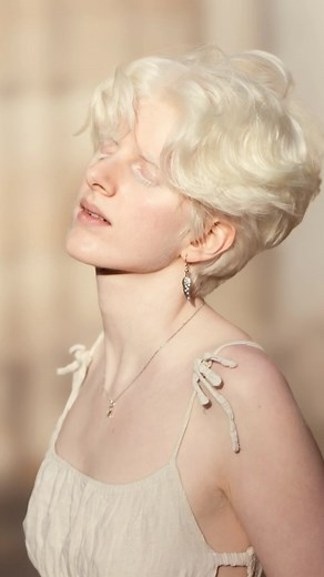 I met Anais in the supermarket and was impressed by her beauty and unique style. She’s originally from Spain and recently moved to Germany. I asked her to be my photo model, and finally, we did a photoshoot in the historical part of my city. What do you think about her pictures? #portrait #streetphotography #dresden #dresdenaltstadt #alopecia #alopeciamodel #عکاسی#آلمان# مدل#سفید | Nina Houshmand