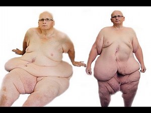 Fattest Guy In The World Loses 630 Lbs - Paul Mason