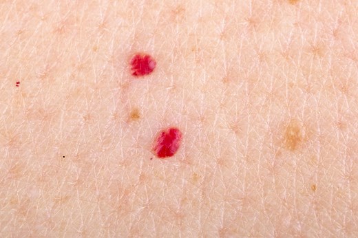 If you see tiny red dots on your skin, here’s what it means, says a dermatologist