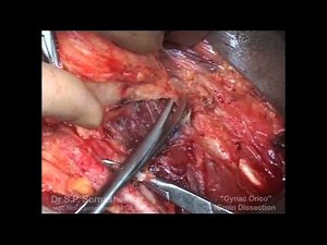 Groin Block Dissection