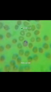 11K views · 40 reactions | Malarial Parasite Under Microscope  #highlightsシ゚ #foryoupagereels #viralreelsfb #newviralreelsvideo #viralreelsfacebook #viralreelschallenge #fluidexamination #tiktokviral #views1m #instagramreels #malaria #microscope #mlt #todaybestvideo #viralvideo #viralreels #parasitology #microscopy #tiktokviral #viralreelsfb @topfans MED LAB ZONE Abdul Halim SaMrr Alii RoseApple Darathorn | MED LAB ZONE | Facebook