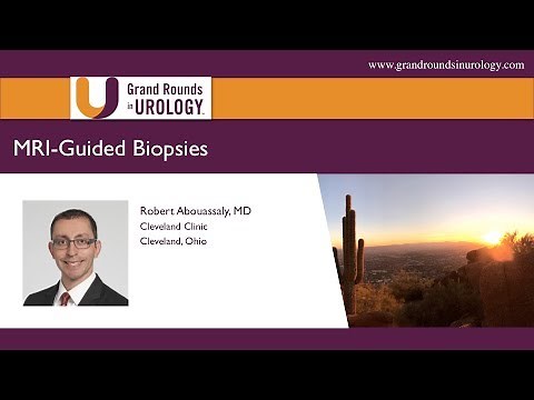 An Overview of MRI Guided Biopsies for Prostate Cancer
