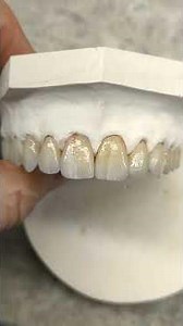 ZrO2, полная анатомия, окрашивание