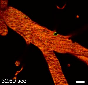 File:Experimental-Cerebral-Malaria-Pathogenesis—Hemodynamics-at-the-Blood-Brain-Barrier-ppat.1004528.s036.ogv - Wikimedia Commons