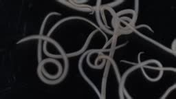 The nematodes , roundworms or eelworms constitute the phylum...