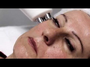 Radio Frequency using Tripolar technology