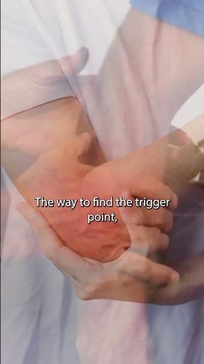 Locating the Trigger Point in the Supinator Muscle