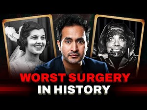 Lobotomy – The Most Horrifying Surgery in History