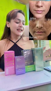 Skin Therapy ☎️ 9220914284 #facetreatment #faceglow #facebrightening #skincare #viral #nishalambha #instagood #pigmentationtreatment | Nisha Lambha - Sparsh Beauty Care & Hair Treatment LLP