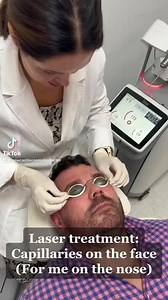 17 reactions | This video is of small blood vessel treatment on the...