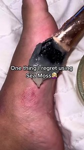 If you struggle with rashes, psoriasis or eczema…. Try sea moss 🌊 🪸Everyone should have sea moss in their everyday household😉#guthealth #anxiety #dandrufftreatment #stress #plantbased #healthtips #health #instagood #satisfying #goodvibes #tuesdaymotivation #tuesday #healthinspiration #healthinfluencer #vegan #vegitarian #holistic #teablend #wellnesstips #teatime #spillthetea #drsebi #houston #acne #oddlysatisfying #eczema #explorepage #fyp #psoriasis #seamoss | Meelah Moss